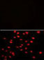 PI4K2A  (PI4K II) Antibody (N-term)